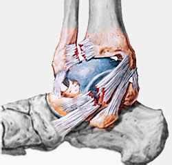 Chronic Ankle Instability | Best Foot and Ankle Specialists Los Angeles