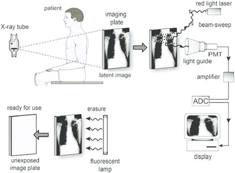 Image formation in CR [1]. | Download Scientific Diagram