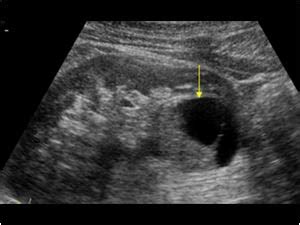 Urinary Tract and male reproductive system | 2.1 Kidney and ureter ...