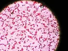 Campylobacter - Classification, Jejuni, Infection and Gram Stain