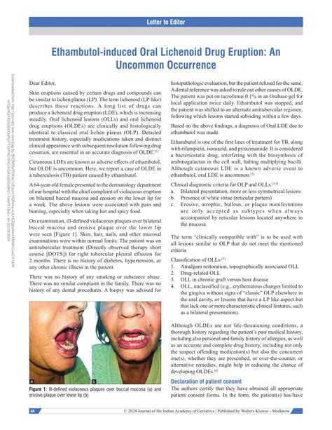 (PDF) Ethambutol-induced Oral Lichenoid Drug Eruption: An Uncommon ...