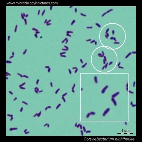 Corynebacterium - Gram stain (Gram+) | Parasitologia, Microbiologia