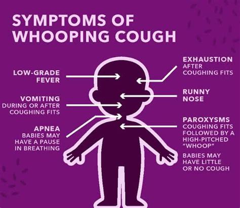 Symptoms of pertussis - MEDizzy