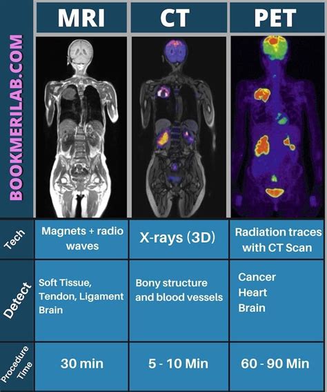 PET CT Scan - Price, Purpose, Side Effects & Proven Benefits [2024]