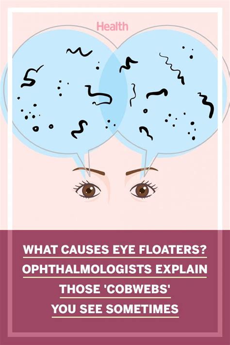 Eye floaters ophthalmologists explain causes symptoms and treatment ...