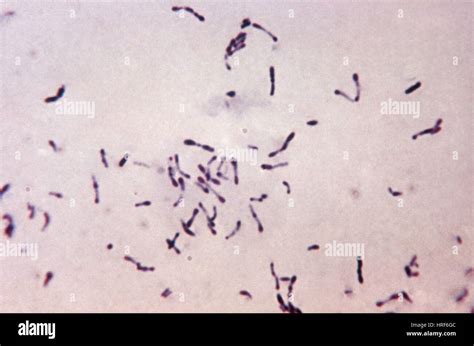 Corynebacterium Gram Stain