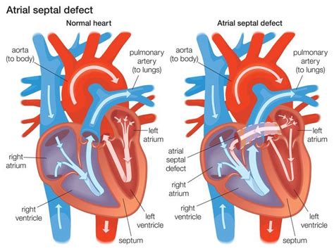 Pin on Cardiac