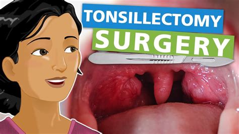 Tonsillectomy Surgery - YouTube