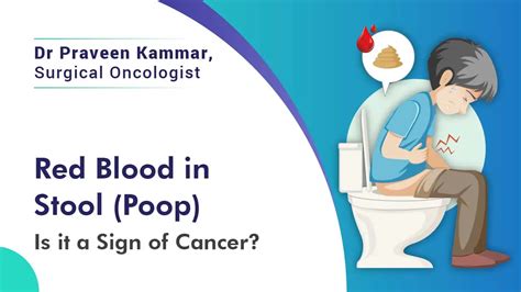 Red Blood in Stool (Poop) – Is it a Sign of Cancer? Dr Praveen Kammar