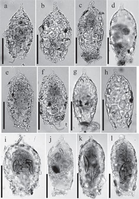 Different specimens of Difflugia acuminata var. inflata from E ...