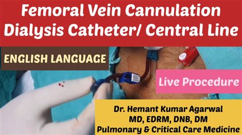 Femoral Vein Cannulation/ Dialysis Catheter/ Central Line/ CVP (ENGLISH ...