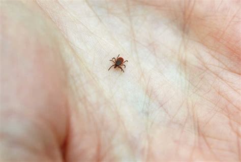 Don't Panic If You Get Bit By A Tick. Here Are 5 Tips To Minimize Lyme ...