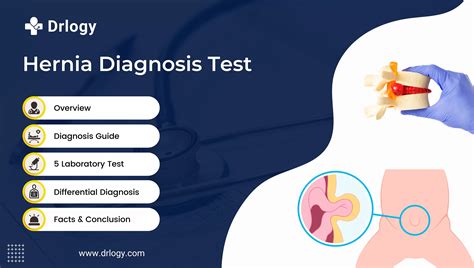 How Hiatal Hernias Are Diagnosed, 47% OFF | www.elevate.in