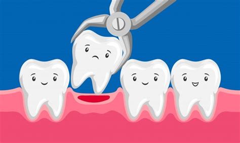 Why You Shouldn't Worry About Tooth Extraction | Dr. Hube Parker