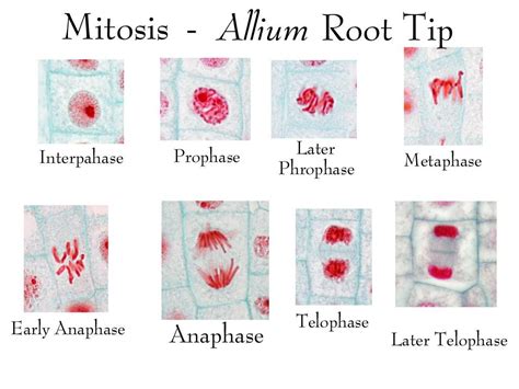 ‎Composite of all stages of mitosis in onion root tip labeled - UWDC ...