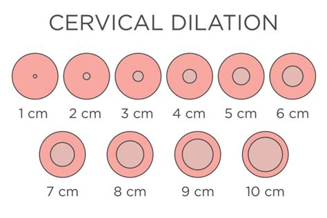 Cervix Dilation Chart: Signs, Stages And Procedure To Check, 47% OFF