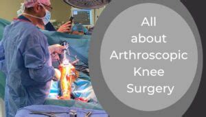 All about Arthroscopic Knee Surgery - Dr Omar Sabri