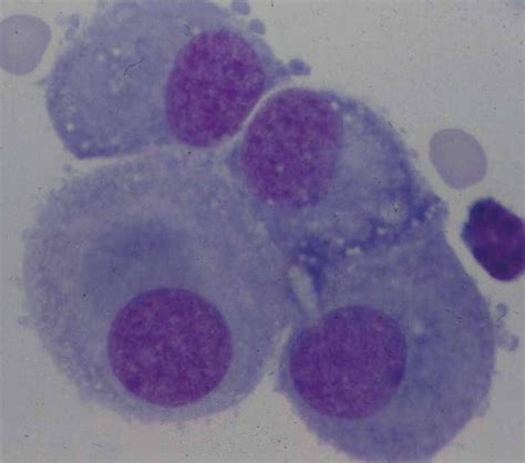 Mesothelial cells with window and microvilli | Hematology, Medical ...