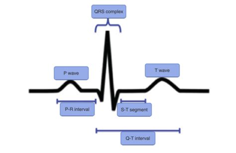 Normal Ecg Tracing