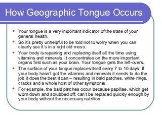 Home treatment for geographic tongue