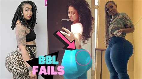 BBL Fails | Before & After Images are Shocking !!! - YouTube