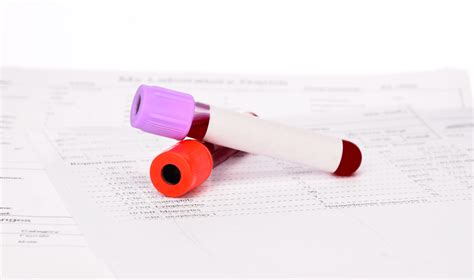 Folate & Vitamin B12 - Private Blood Tests