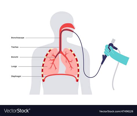 Bronchoscopy procedure concept Royalty Free Vector Image