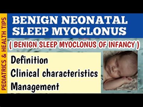 Benign Neonatal Sleep Myoclonus (BNSM) Symptoms Diagnosis and Treatment ...