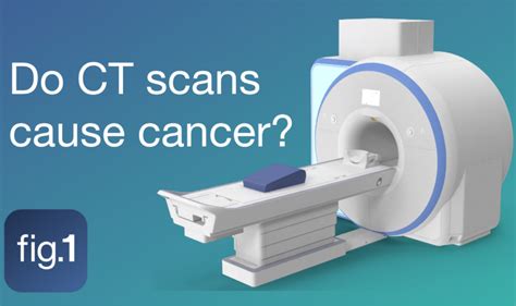 Does Radiation Exposure from CT Scans Increase Your Risk of Cancer ...