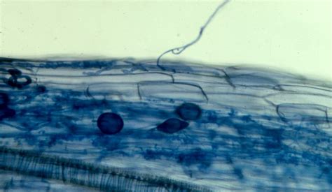 Glomeromycota