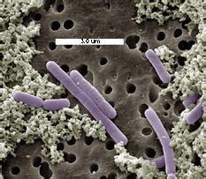 Lactobacillus casei - Alchetron, The Free Social Encyclopedia