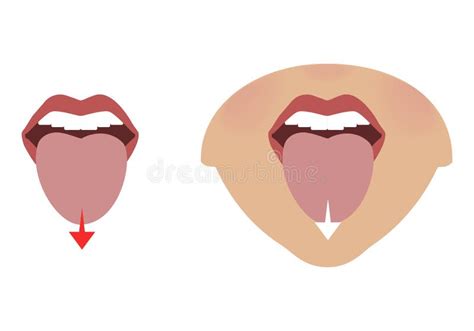 Exercises for the Expression Muscles Around the Lips and Mouth ...