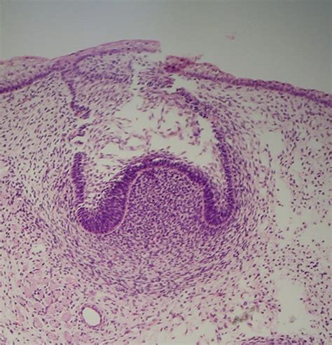 Tooth Histology