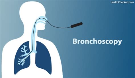 Bronchoscopy Procedure & Complications | Health Checkup