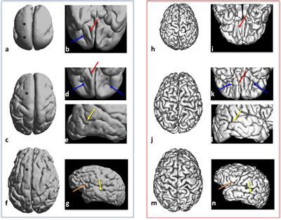 Frontiers | Structural and Diffusion MRI Analyses With Histological ...