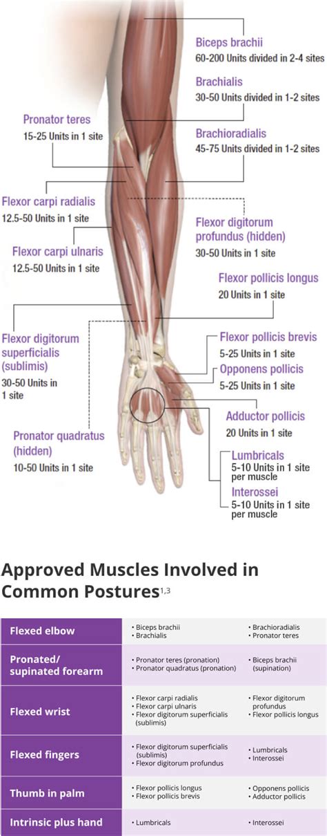 Upper Limb Spasticity