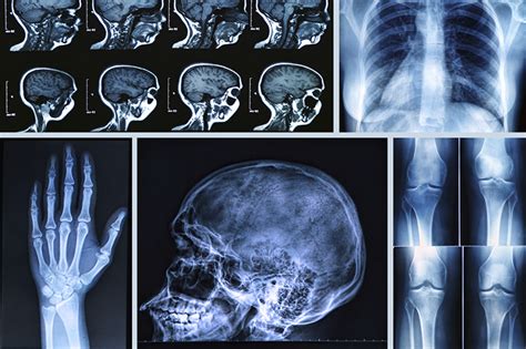 诊断成像技术:x射线，CT和MRI扫描