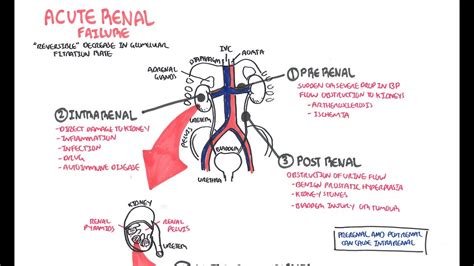 Acute Renal Failure - YouTube