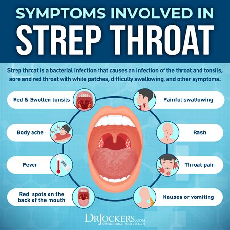 Strep Throat: Symptoms and 15 Natural Support Strategies | Strep throat ...