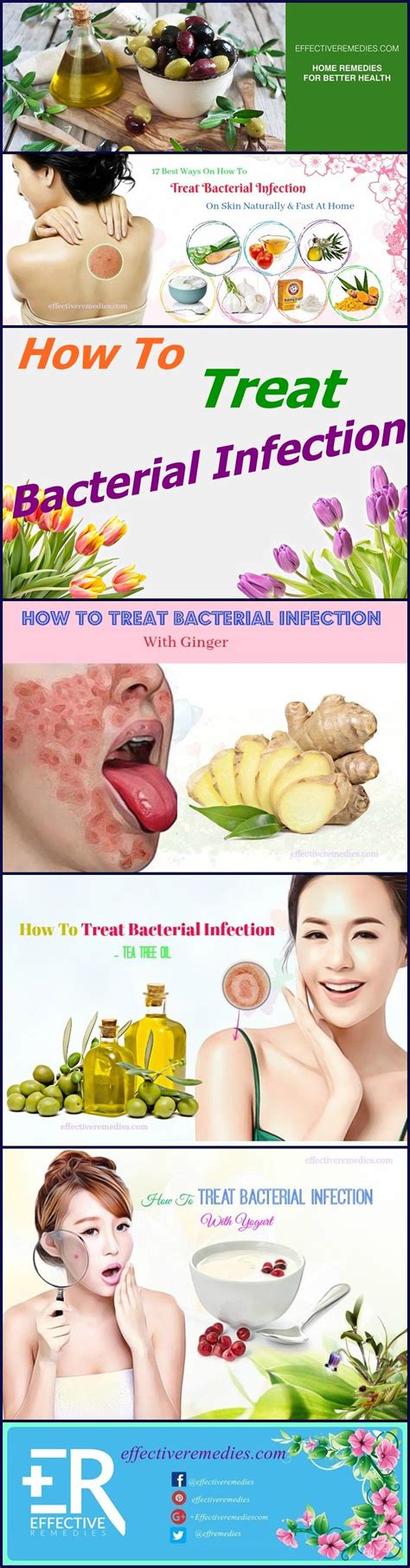 17 Best Ways To Treat Bacterial Infection On Skin Naturally & Fast At ...