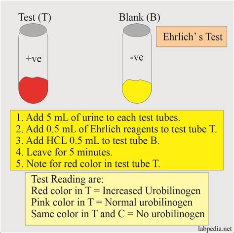 Urine for Urobilinogen