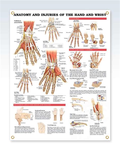 Injuries of the Hand and Wrist Exam Room Anatomy Posters – ClinicalPosters