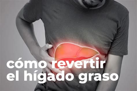 ¿Cómo revertir el Hígado Graso? Causas, Tratamiento y Dieta.