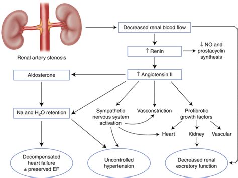 Renal Artery Stenosis Treatment | Renew Physical Therapy