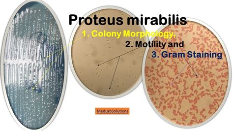 Proteus mirabilis Colony Morphology, Motility and Gram Staining - YouTube