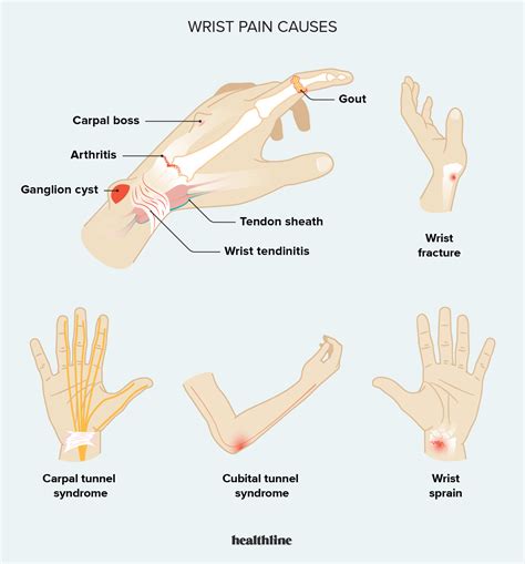 Please stop extremely painful – Telegraph