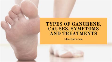 Gangrene: Types of Gangrene, Causes, Symptoms and Treatments - Idea Clinics