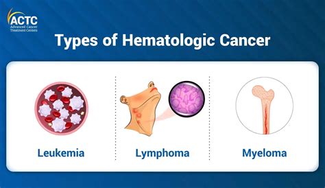 All You Need to Know About Hematologic Cancer | ACTC