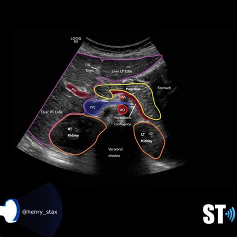 Liver Anatomy and Protocol | Medical ultrasound, Liver anatomy ...