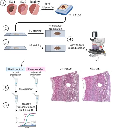 Schematic representation of the study design. (1) Formalin-fixed ...